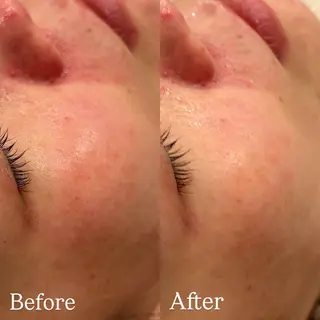 Hari Lounge恵比寿所属・chika🦋 ハリラウンジ恵比寿のエステ・リラクイメージ