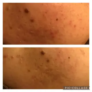 ミディアム カラー パーマ ヘアアレンジ メンズ キッズ ネイル マツエク・マツパ アニメ,Vオタク× 即効痩せエステサロンのエステ・リラクイメージ