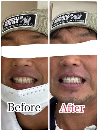 メンズ キッズ マツエク・マツパ アイブロウ プラチナムビューティー柏所属・【歯科提携】柏ホワイ トニングスタイルのその他イメージ