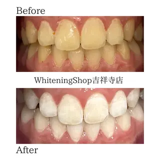 ホワイトニング専門店 御殿山/吉祥寺店のその他イメージ