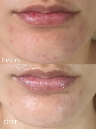 WHITE AQUA 北千住店のエステ・リラクイメージ