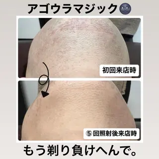 メンズ メンズ脱毛サロン Le falcoのエステ・リラクイメージ