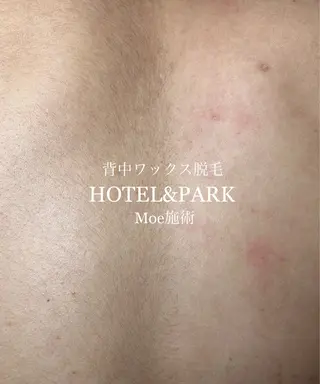 HOTEL&PARK . ワックス脱毛のエステ・リラクイメージ