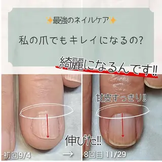 ネイル AKT NAIL所属・AKT Beauty エステヘッドスパのエステ・リラクイメージ