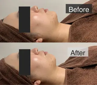 脱毛専門サロン BELFINE恵比寿のエステ・リラクイメージ