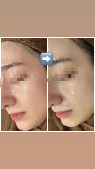 カラー パーマ ヘアアレンジ メンズ キッズ ネイル マツエク・マツパ アイブロウ Amaryllis 🌹松本のエステ・リラクイメージ