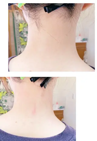 ネイル＆脱毛 Lotus🌸のネイルデザイン