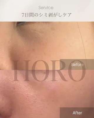 毛穴が見えなくなるサロン Horo所属・岡 えり子のエステ・リラクイメージ