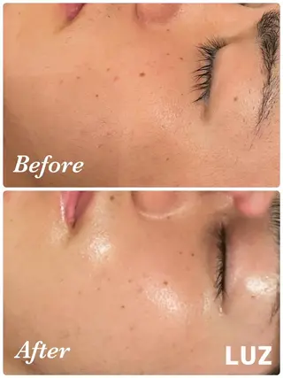 メンズ メンズフェイシャル アイブロウ・ルースのエステ・リラクイメージ