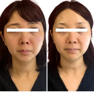 Astorie 相模大野エステのその他イメージ