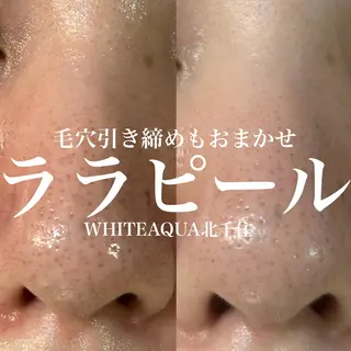 WHITE AQUA 北千住店のエステ・リラクイメージ