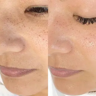 メンズ salonLADYSTYLE所属・稲嶺 美華のエステ・リラクイメージ