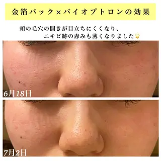 Bellesthe (ベルエステ)のエステ・リラクイメージ