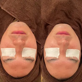 メンズ 毛穴ケア/毛穴診断/ 毛穴洗浄〔心斎橋〕のエステ・リラクイメージ