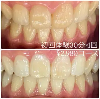 PLATINUM Beauty 横浜店所属・ホワイトニングルーム 横浜店のその他イメージ