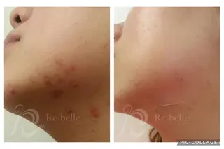 Lavi&所属・肌質改善サロン Lavi&のその他イメージ