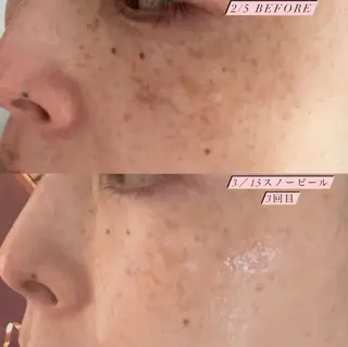 フィユ所属・〚博多〛フィユ 水江のマツエク・マツパデザイン