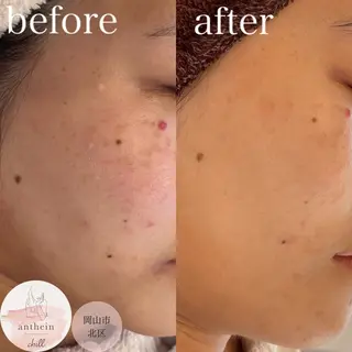 アンテインチル 山本のエステ・リラクイメージ