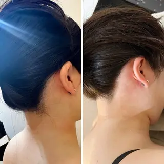 うなじ脱毛/美肌脱毛 LABELのエステ・リラクイメージ