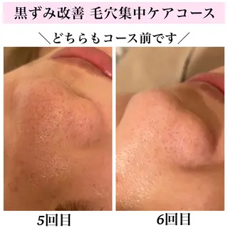 Bellesthe (ベルエステ)のエステ・リラクイメージ