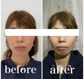 小顔と ヘッドスパのお店のエステ・リラクイメージ