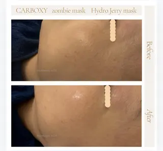 艶肌ワックス ALLY.のエステ・リラクイメージ