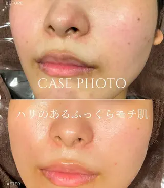 12月より リニューアルオープンのエステ・リラクイメージ