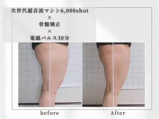 小顔矯正専門店 【RED】池田のエステ・リラクイメージ