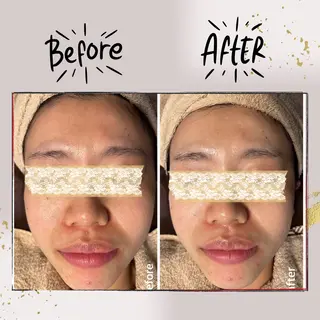 ピーリング専門店 Belluteのエステ・リラクイメージ