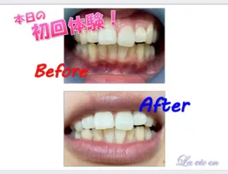 セルフホワイトニングサロン　ラヴィアン所属・ホワイトニングサロン La vie enのその他イメージ