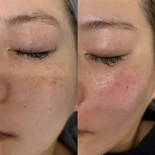 西脇 有紀のエステ・リラクイメージ