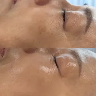 skinity所属・ピーリング専門サロン skinityのエステ・リラクイメージ