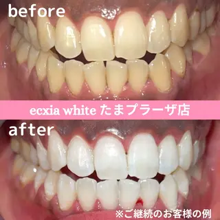 セルフホワイトニング　エクシアたまプラーザ店所属・セルフホワイトニング エクシアたまプラーザのその他イメージ