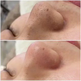 ✨美肌水光✨ アトリエリュバンのエステ・リラクイメージ