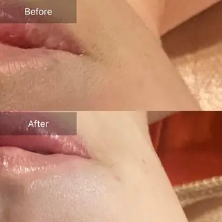 Mandarin Orange所属・毛穴から始める肌メン テマンダリンオレンジのエステ・リラクイメージ