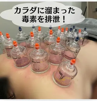 美容鍼/鍼灸 ここみ鍼灸院のエステ・リラクイメージ