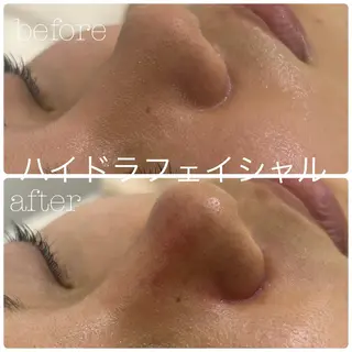 フェイシャルサロン CHIARA 荒田のエステ・リラクイメージ