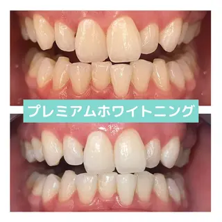 ホワイトニング|韓国式3D毛穴洗浄 lonhana ロンハナ所属・韓国式3D毛穴洗浄 lonhanaのその他イメージ