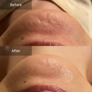 Mandarin Orange所属・毛穴から始める肌メン テマンダリンオレンジのエステ・リラクイメージ