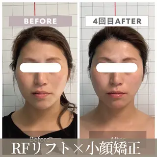 小顔矯正専門店 【RED】池田のエステ・リラクイメージ