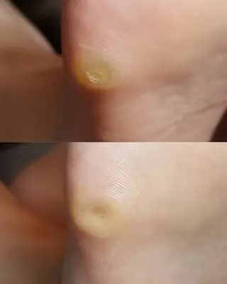 ネイル ROUN' 齋藤のエステ・リラクイメージ