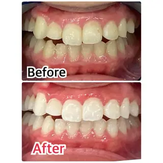 キッズ ネイル マツエク・マツパ アイブロウ プラチナムビューティー柏所属・【歯科提携】柏ホワイ トニングスタイルのその他イメージ