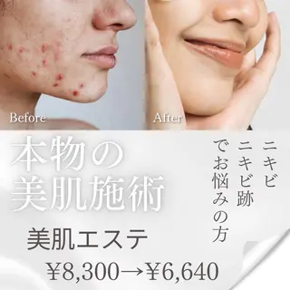 メンズ キッズ 脱毛・エステサロン Luangeのエステ・リラクイメージ