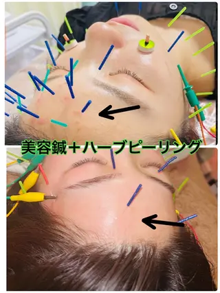 美容鍼灸サロン mahoroba院長のエステ・リラクイメージ