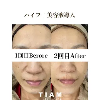 美肌サロンTIAM by tetoteのエステ・リラクイメージ