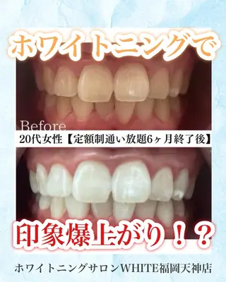 メンズ キッズ ホワイトニング専門店 WHITE天神店のエステ・リラクイメージ