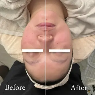 ✨美肌水光✨ アトリエリュバンのエステ・リラクイメージ