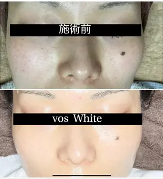 代表 MOMOの眉毛・アイブロウイメージ