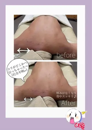 豊胸級バスト術🌻 エステサロン向日葵のエステ・リラクイメージ