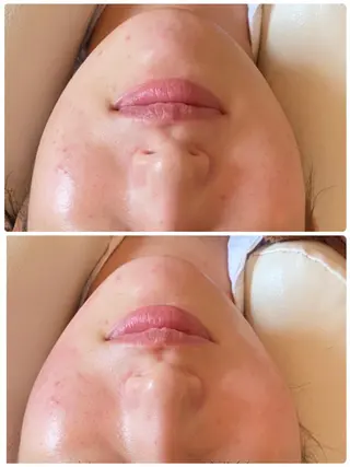 FLEUR大阪・整体 ・ハイフ・痩身・小顔のエステ・リラクイメージ